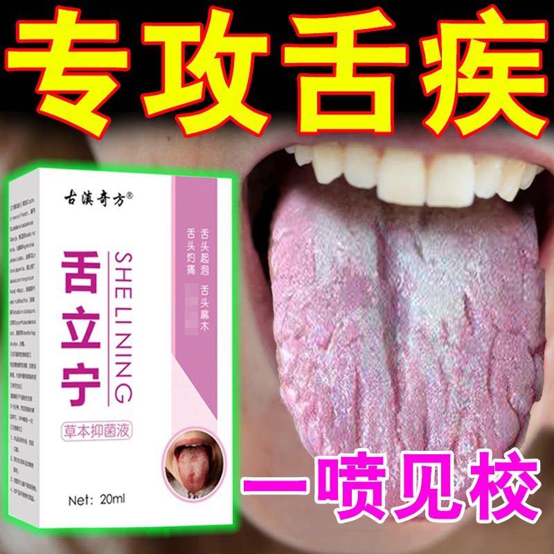 Tongue inflammation map tongue crack tongue nipple pain cracking blister rotten mouth numbness red swelling sore pain relief artifact