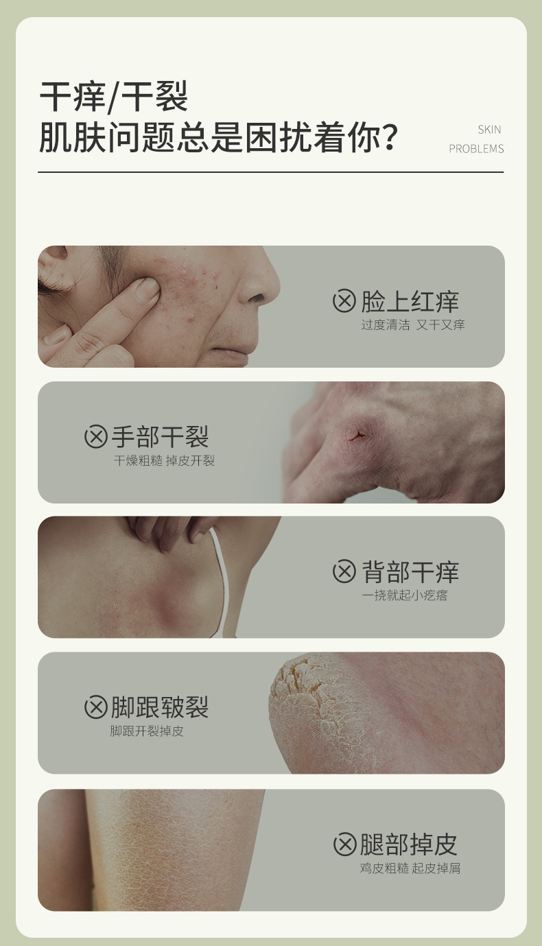 后辰 鸸鹋油身体乳秋冬脚后跟干裂凡士林 30g 9.9元包邮 值值值-买手聚集的地方