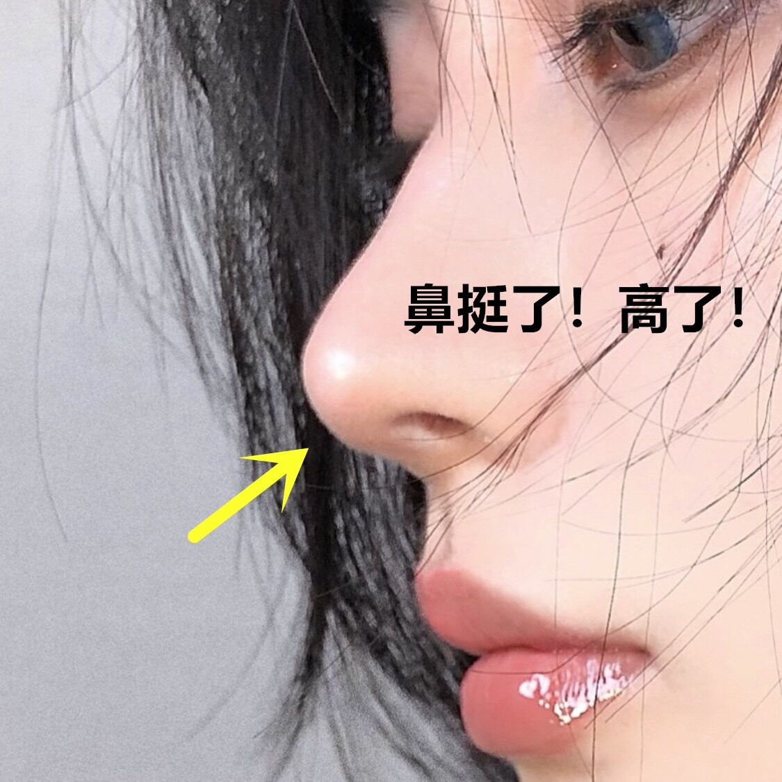 Japan Nose Giri Briskler Nose Clip Nose Clip nose Nose Heightening Instrumental Invisible Nostrils Narrowing Nose Wing Pads Correction-Taobao