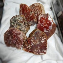 Jingjing Gem Jie] Live special link link Cherry Blossom Agate Bracelet High Ice Green Chalcedony Thin