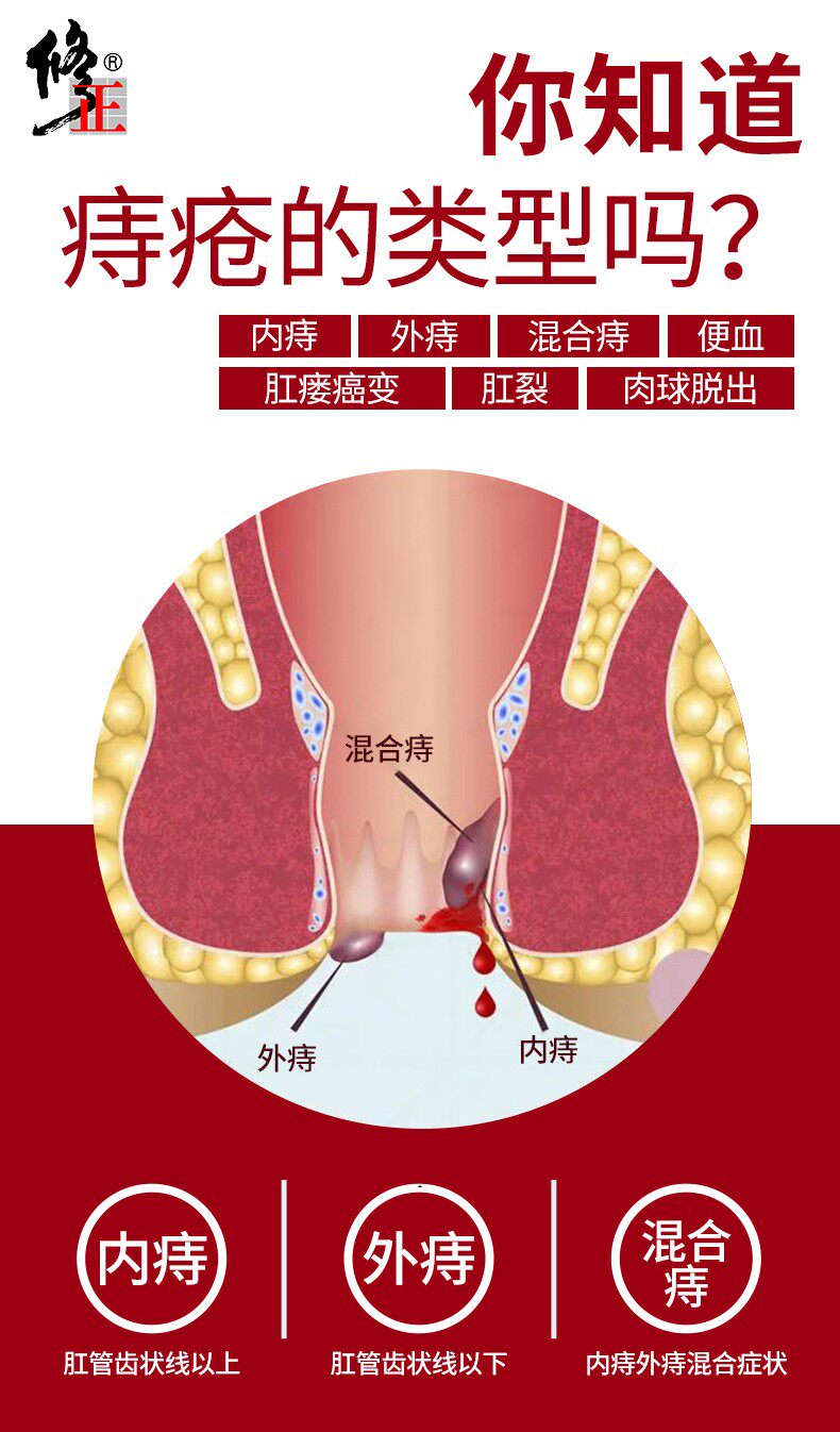 修正 痔疮膏 消内外混合痔 图3