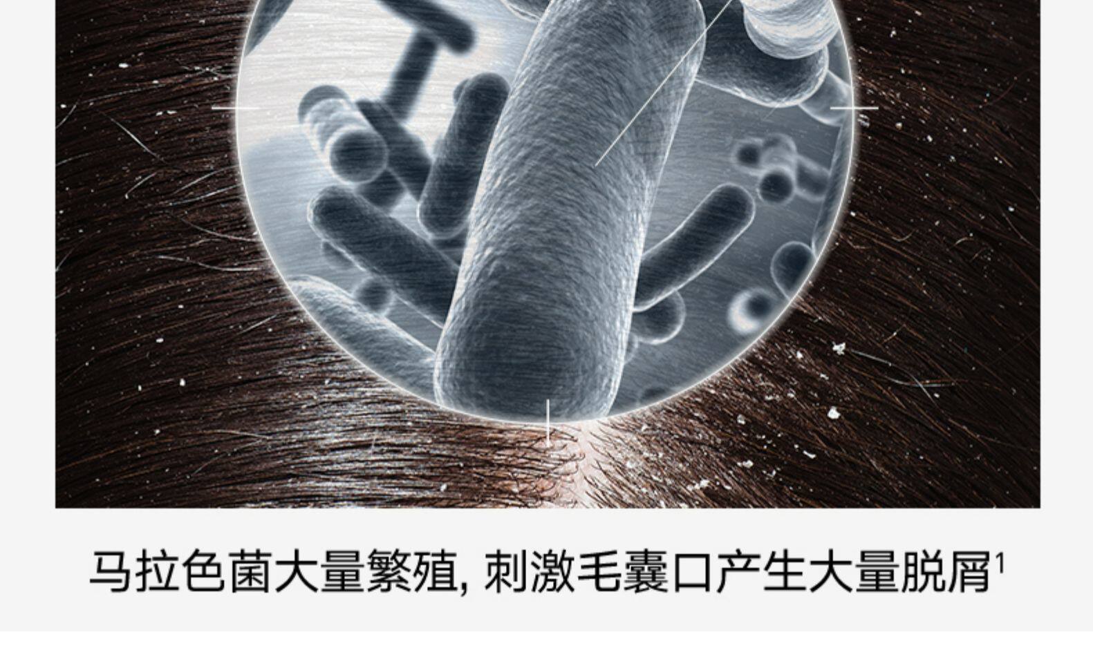 澳洲进口 selsun 洗发水无硅油 200ml 图5