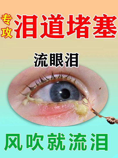 专治迎风流泪滴眼液眼睛流眼泪泪道堵塞眼药水眼睛痒经常怕冷风用