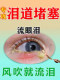 专治迎风流泪滴眼液眼睛流眼泪泪道堵塞眼药水眼睛痒经常怕冷风用