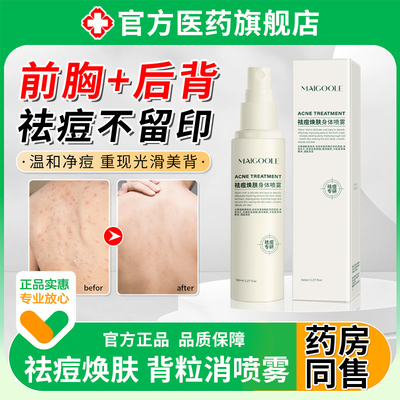 祛痘焕肤身体喷雾水背立消后背前胸脸部喷雾青少年修复换水杨酸硫