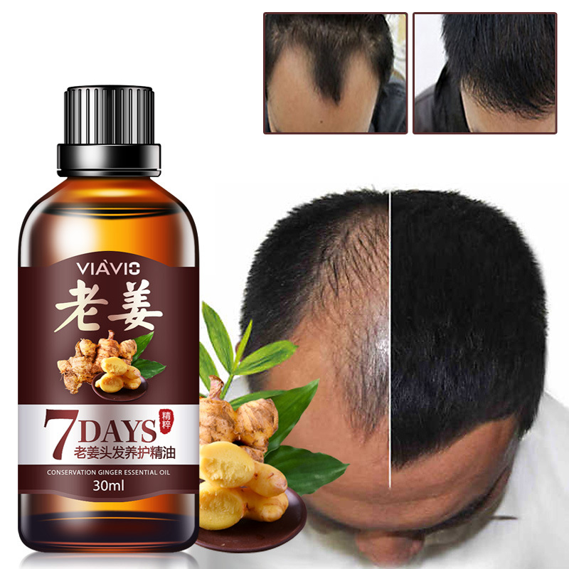Unisex 30ml Effective Fast Hair Growth Essential Oil Hair Lo