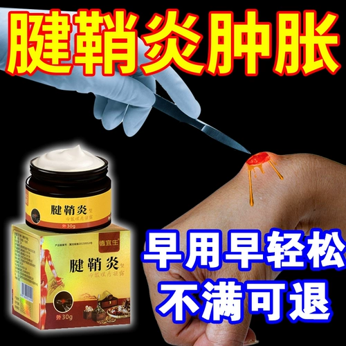 Сундоносиновит использует гипсовые пасты и запястья боли сухожили