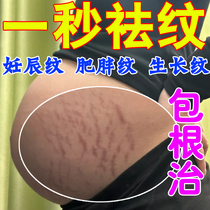 Prevent growth marks obesity lines white lines postpartum belly laxity stretch marks postpartum repair cream for pregnant women during pregnancy