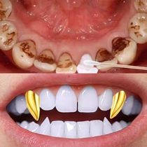 (Watson’s best seller) Teeth whitening tool for both men and women no need to ask anyone to remove yellow teeth remove stone stains tobacco stains and tea stains