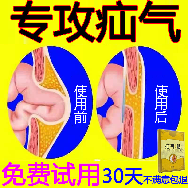 Jiadan xenon paste Ruiduan Jiutang No. 6 old man day child listen to inguinal hernia umbilical hernia abdominal hernia listen
