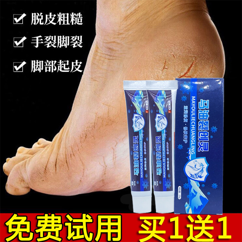 Anti-cracking cream, unicorn skin exhaustion, moisturizing treasure, frozen crack repair cream, dry cracked hands and feet, edc, Ningbikang, cracked, ebc, good ede