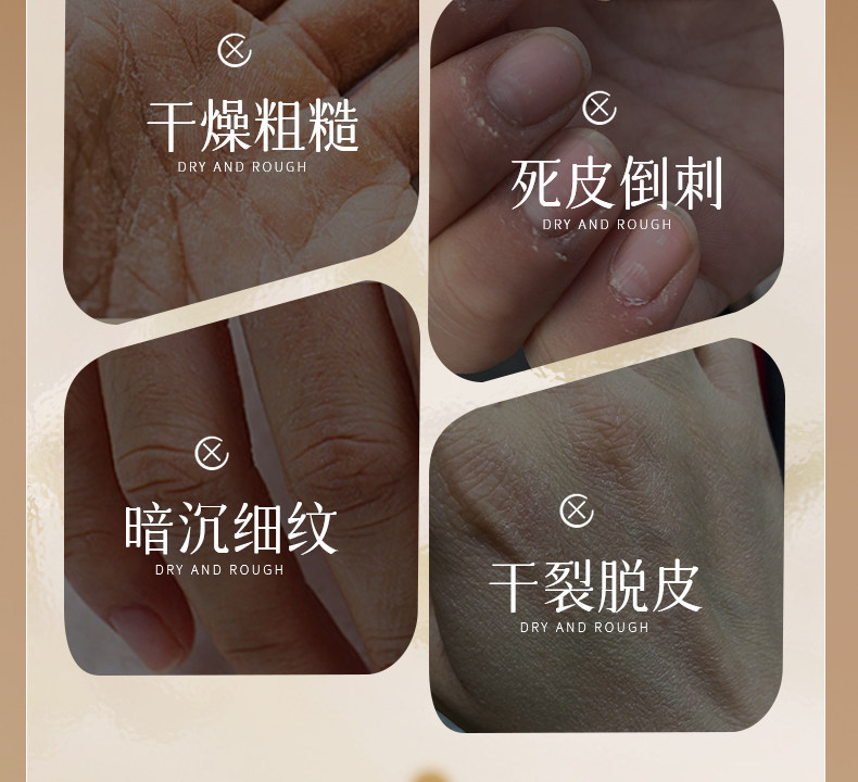 【中国直邮】  奢笛熊 手膜 嫩白保湿补水修复干裂粗糙淡化手纹滋润保湿手部美白手套 10片(5对)