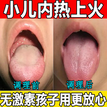Pediatric internal heat conditioning accumulated food paste spleen and stomach paste childrens stomach and digestion paste baby navel paste baby spleen paste