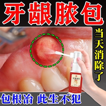 Gum pus tooth root inflammation gum swelling and pain anti-inflammatory medicine gum hyperplasia irritation gingivitis special spray