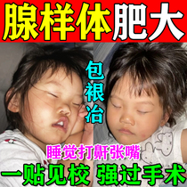 Adenoid hypertrophy traditional Chinese medicine paste conditioning childrens nasal congestion baby sleeping open mouth breathing face corrector