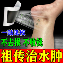 (All edema disappears) edema stickers for the elderly diuretic drainage swollen hands and feet limbs body edema edema artifact stickers