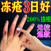 Hand cream anti-cracking anti-cracking artifact hand ear heel frostbite detumescence anti-itching special anti-cracking Vaseline