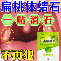 Tonsil Body Calculus Removal Tool Suction to remove throat heterosexual sensation Tonsil Inflammation Hypertrophy Dry Itch