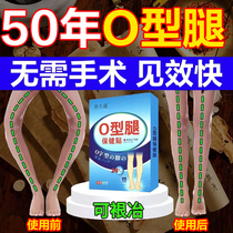 o type leg filling to change straight to improve adult and adult children o-type legs Roosphere leg calf valgus corrects leg-type deity