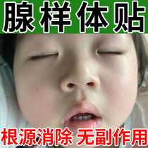 Childrens gonad-like body Mast Chinese Herbal Medicine Conditioning Mouth Veneered to correct Zhangs mouth and snore the nose of the Qi Qi Without Qi