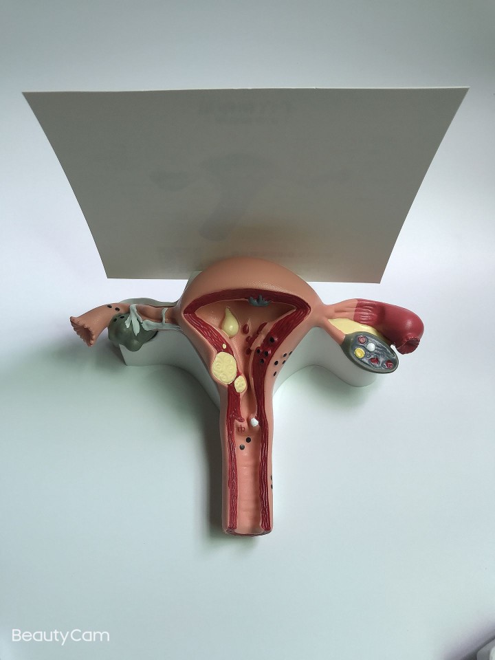 人体女性生殖子宫解剖病理展示模型 教学模型 妇科教具新款包邮