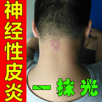 Treat stubborn itching neurogenic hormone-free dermatitis and remove imported solid dermatitis with ointment and root removal.