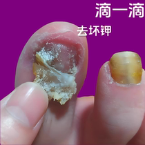 (Tongrentang hot sale) Painless replacement of potassium enjoy a good nail life turn bad nails into good ones drop by drop
