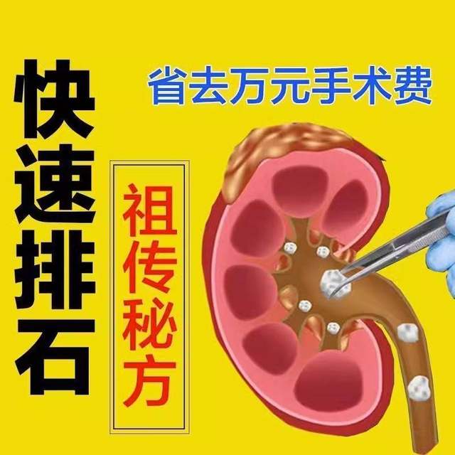 ກ້ອນຫີນຫາຍໄປ] Gallus gallus domesticus gravel pills to remove the stones, dissolve stones, remove ureter, gallbladder, ພົກຍ່ຽວ, ໜິ້ວໃນໄຂ່ຫຼັງ ແລະ ໜິ້ວ