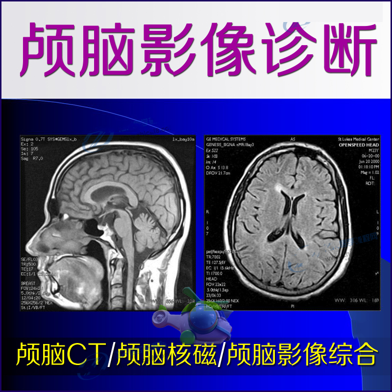 Brain imaging diagnosis Brain CT MRI reading instruction video tutorial Nervous system image analysis