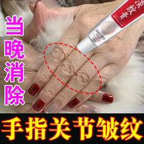 Hand cream to remove wrinkles on finger joints remove hand lines fade away whitening moisturize and repair roughness on the back of the hand and rejuvenate the skin.