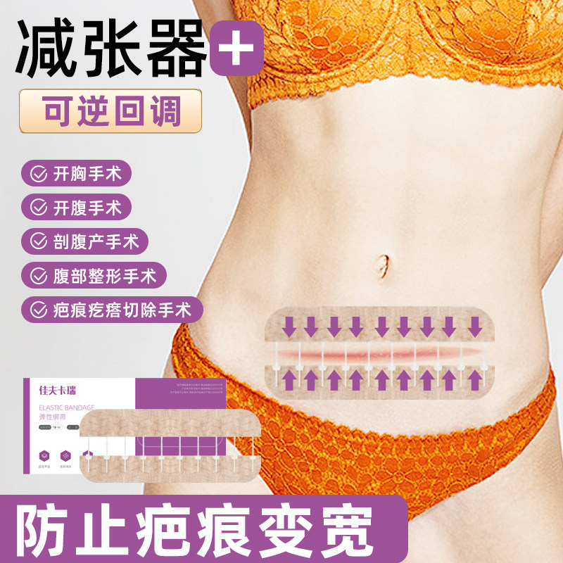 医用减张器剖腹产疤痕减张贴拉链式伤口免缝合皮肤闭合创可贴