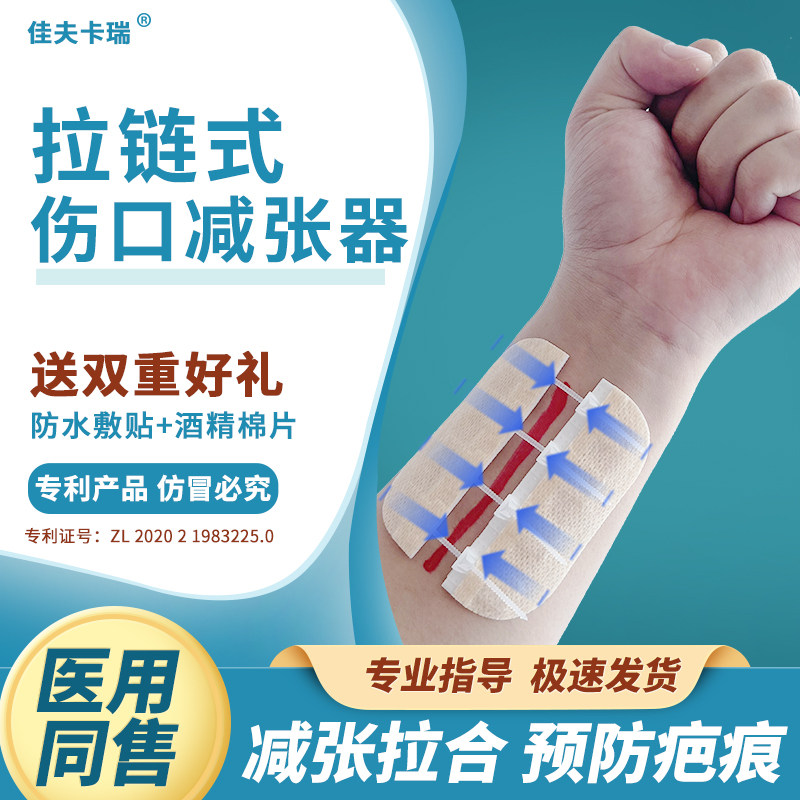 拉链式疤痕减张器 免缝针创口贴 医用弹性绑带推荐