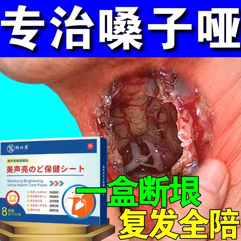 嗓子哑声音嘶哑声带修复儿童喉咙沙哑声音变好听护嗓神器美声药贴