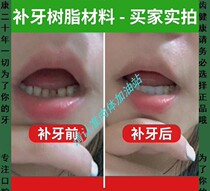 Teeth self-supplemented temporary dental materials for fatigue homemade resin dentures simulation of filling gap for tooth sewing artificial