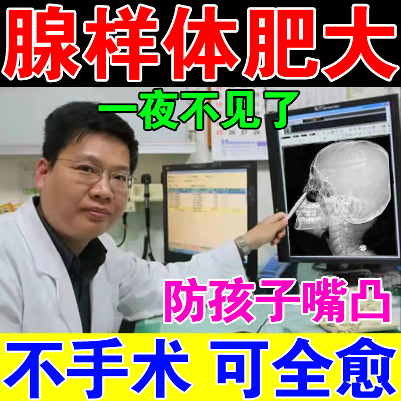 (Three days can be fully cured) Adenoid hypertrophy traditional Chinese medicine patch conditioning face correction ventilation artifact children's big mouth patch