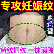 Postpartum elimination of stretch marks stretch mark tightening belly covering artifact cream obesity repair pregnant womens fade cream
