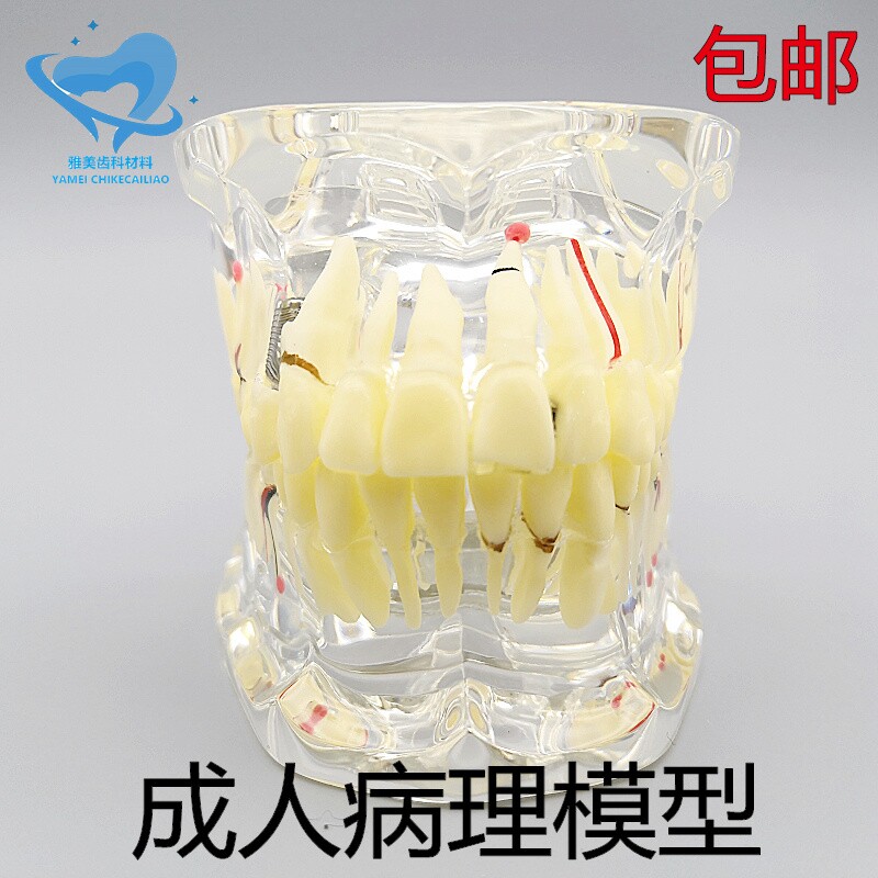 牙科口腔教学模型 成人病理模型透明承认综合病理模型 齿科教学