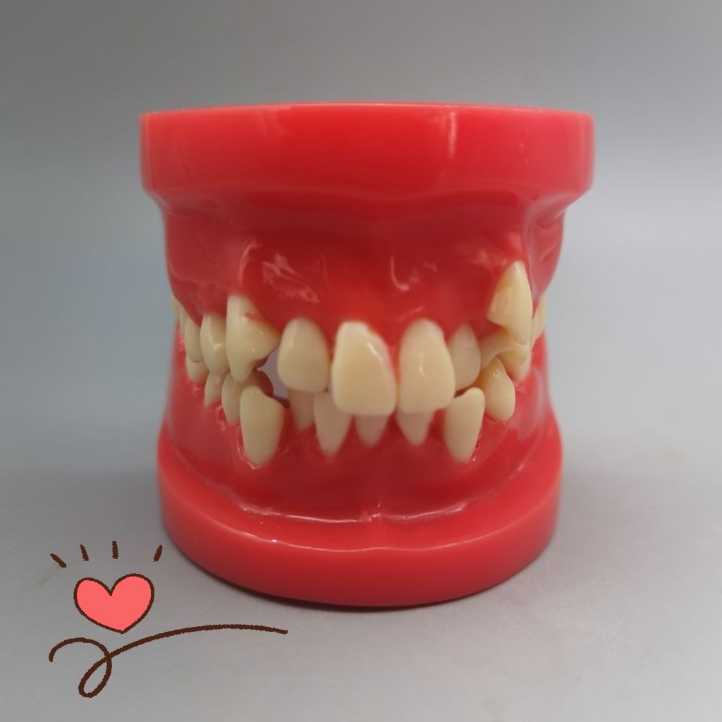 牙科口腔模型 正畸模型 正畸错颌展示模型 口腔教学展示模型 齿科