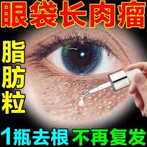 Go to Fatty Grain Perspiration Pipe Neoplasia Eye Removal Divine treatment Khan Tube Grain Grease grains Men and women Special eye Essence