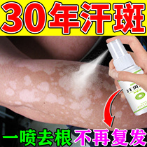 (A Spray to Root) Sweat Platypus Special Medicine Skin External to Flower Spotted Brown Spots White Spotted bacteria infected with anti-itch