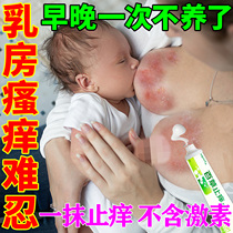 Breast Eczema Ointment Creamy Nipple Pruritus Cracks rifts Cracks Crepes small blisters Blisters Red Spots Special for Anti-Itch Cream