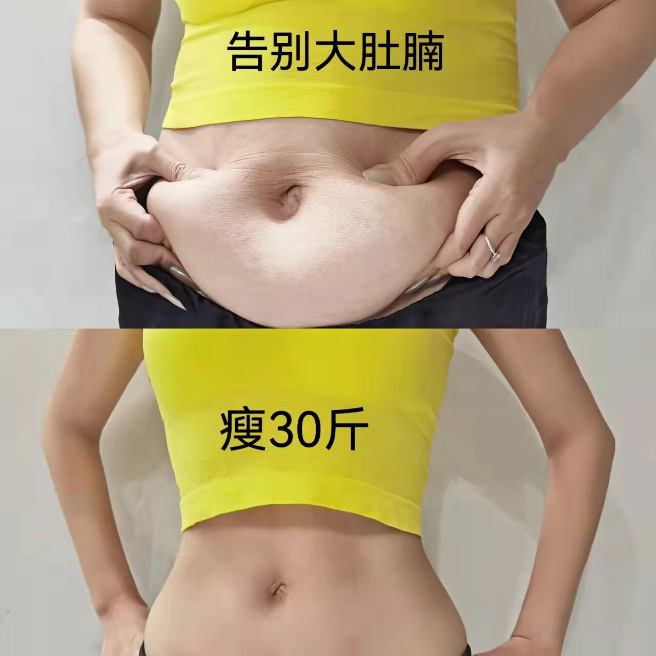 (Recommended by Xiaohongshu) No traces left on the body, no more embarrassment to wear short skirts in summer, buy 5 get 5 free