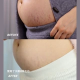 Американский палмерский какао -масло из -за беременности линии ожирения массаж и ремонт. 250 мл 250 мл