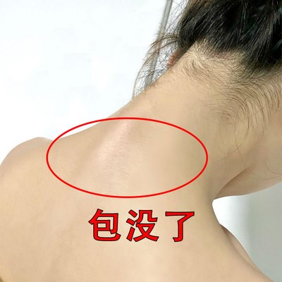 Li Jiaqi recommends that as long as wealth is not included, solve various cervical spine problems and dress more beautifully