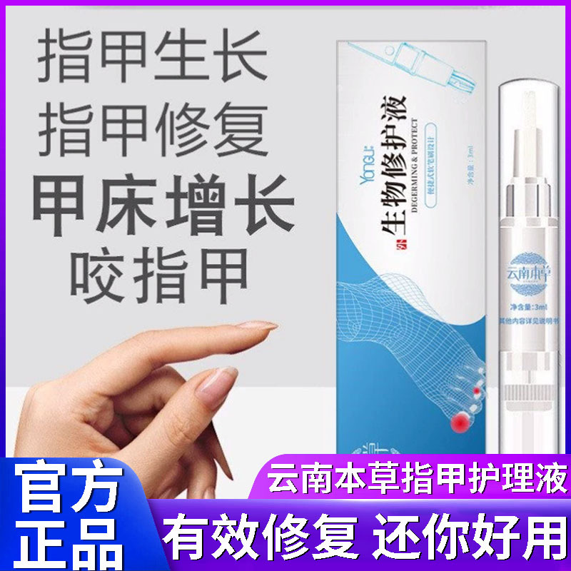 Yunnan Herbal Nail Care Repair Liquid Nail Oil Nail Nourishing Liquid Special Official Genuine Product