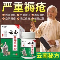 Yunnan bedsore muscle powder for the elderly bedridden bedsore pressure sore diabetic foot old rotten leg wound ulceration suppuration burns and scalding