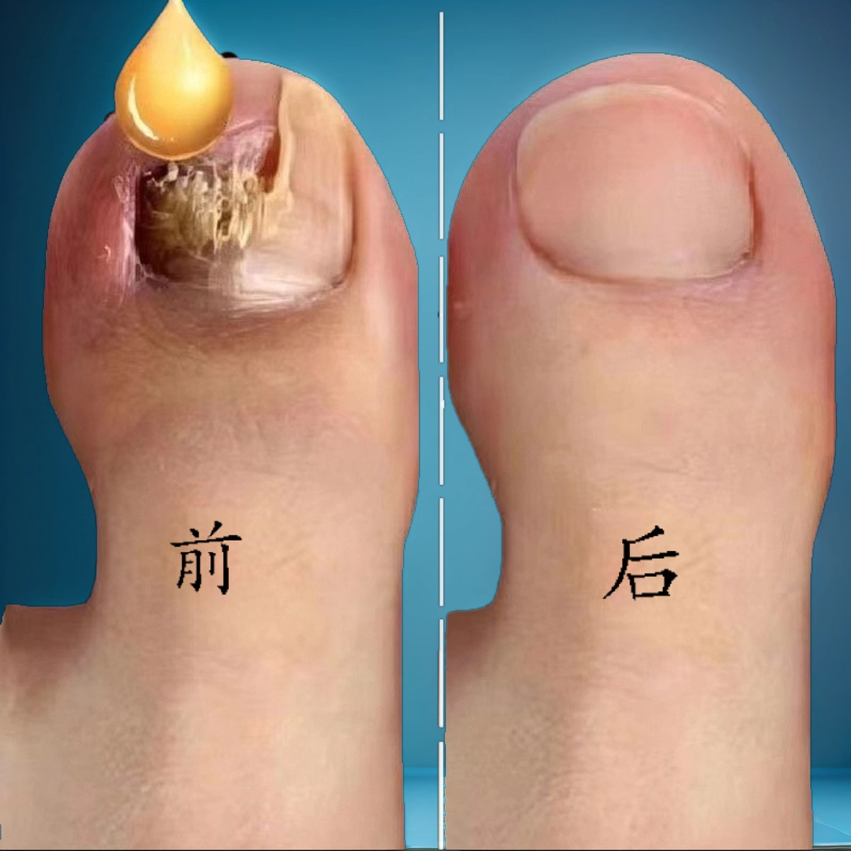 叠氮化钾含氮化合物原料- ChemicalBook, image size:1200x1200