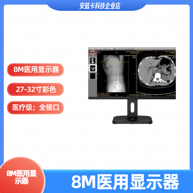 医用放射竖屏显示器 5M-8M灰阶彩阶放射诊断高清 DICOM医疗显示屏