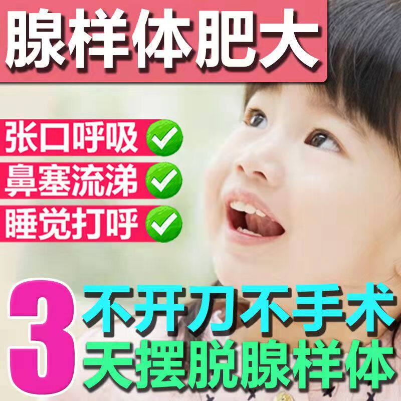 Children's glandy fat-faced with corrective nose blocking face bones change swallowing difficult nose ventilation