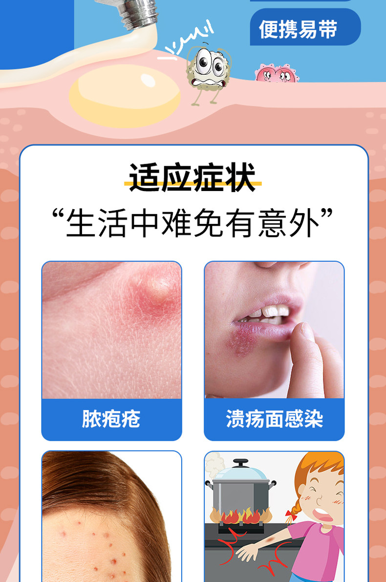 川石   红霉素软膏  抗菌消炎  祛痘 皮炎 烫伤   8g/支